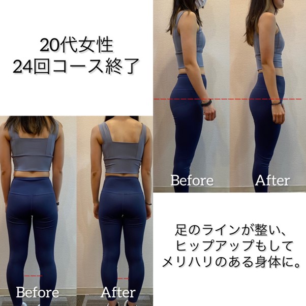 Before After トレーニング効果