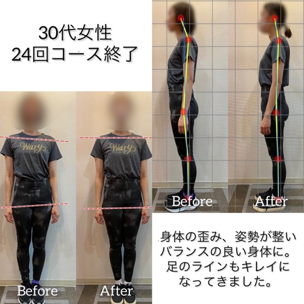 Before After トレーニング効果